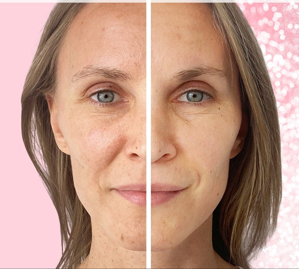 Gezicht voor en na huidverzorging; links rimpels en vlekken, rechts gladde huid. Anti-aging, huidverbetering, huidverzorgingsresultaten.